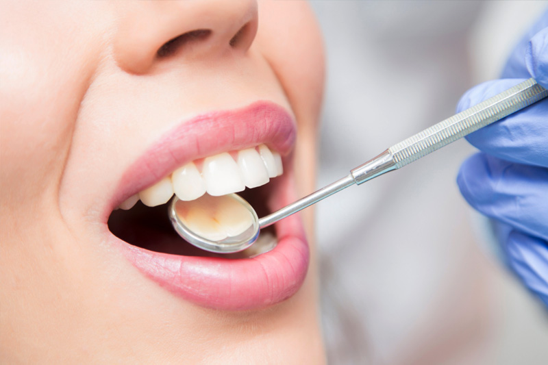 Dental Implants in Morgan Hill